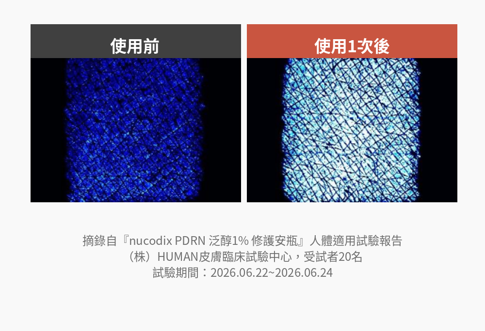 [Roro Pick💘] nucodix 活性修護面膜 4 片裝 + 安瓶套裝