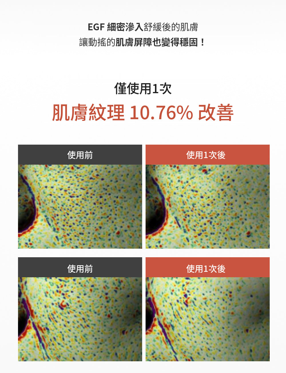 [Roro Pick💘] nucodix 活性修護面膜 4 片裝 + 安瓶套裝