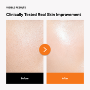 Mặt nạ Nucodix CYTO-NUSET Turnover Repair Sheet Mask